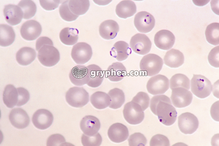 Plasmodium falciparum x400 - gryphea.org